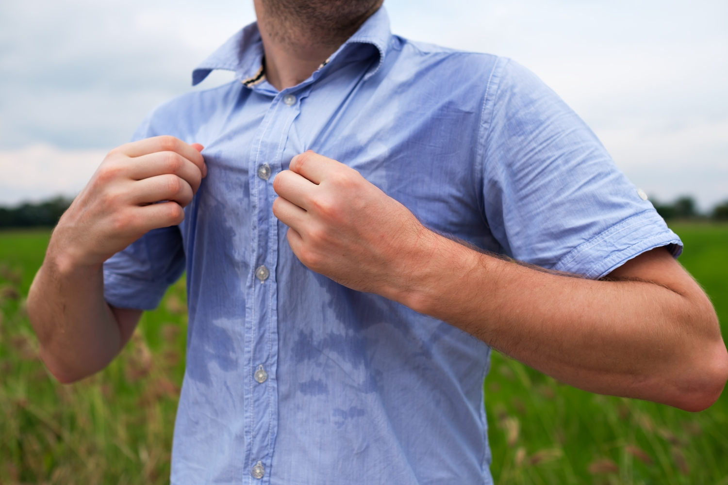 Hyperhidrosis: Causes and Common Treatments