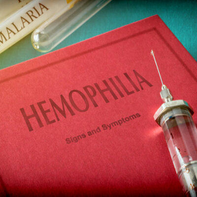 Top Warning Signs of Hemophilia