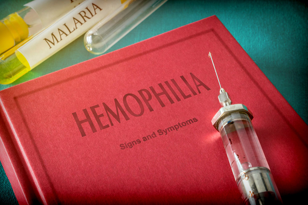 Top Warning Signs of Hemophilia